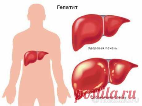 Наше здоровье ВИРУСНЫЙ ГЕПАТИТ