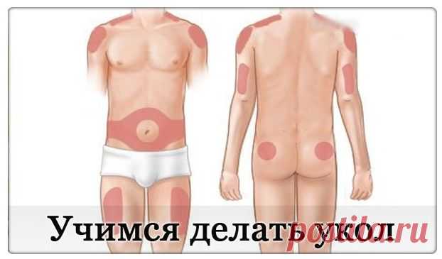 Как делать внутримышечные уколы правильно