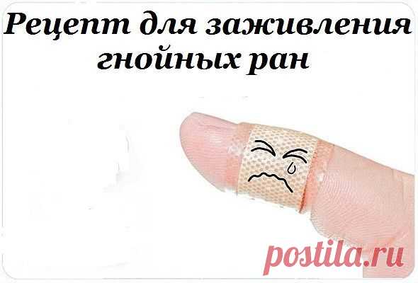 Здоровье >Рецепт для заживления гнойных ран.
