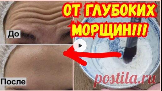 РЕЦЕПТЫ КРАСОТЫ и МОЛОДОСТИ | От Морщин На Лбу не осталось и Следа! Маска сильнее подтяжки. Омолодила кожу лица.