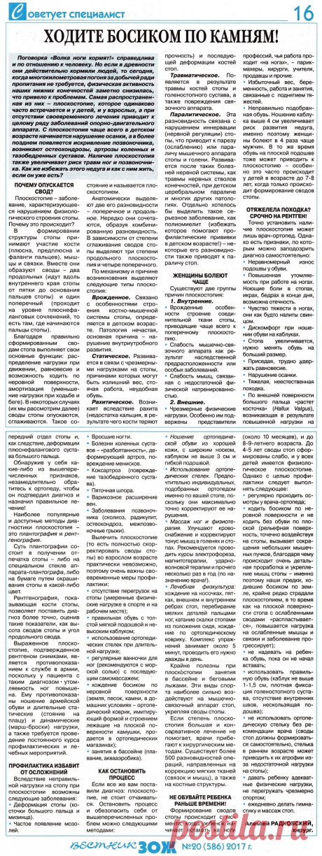 Плоскостопие