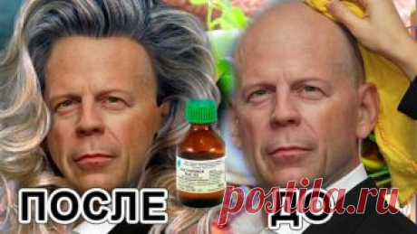 Домашнее масло от облысения и для шевелюры загущения. Готовится долго, действует гениально! | 1001 маска своими руками | Яндекс Дзен