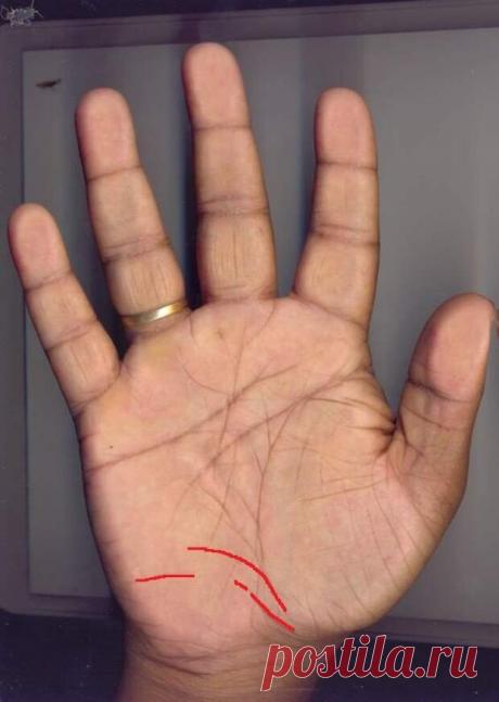 Виа Ласцива - загадочная линия на руке, которая дарует своему обладателю феноменальные парапсихологические способности - Сонники, гороскопы, гадания - медиаплатформа МирТесен Если более внимательно присмотреться к своим рукам, то можно найти подсказки о своем предназначении, своих талантах, скрытых возможностях и даже будущем или судьбе, которая предначертана человеку. Но сегодня мы хотим более подробно поговорить непосредственно о дополнительной. редко и загадочной