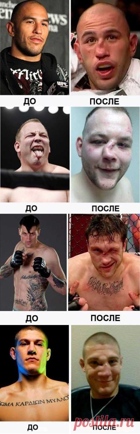 Как ломают носы бойцы MMA