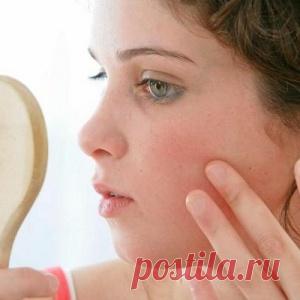 Псориаз : лечение псориаза народными средствами - МирТесен