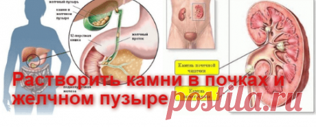 Старинный русский рецепт очищения организма от солей | Советы целительницы
