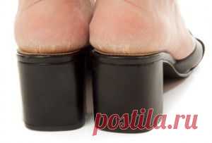 Почему трескаются пятки: причины, лечение и профилактика | Женский мир Elvi