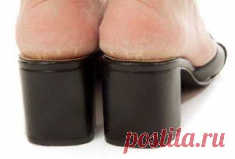 Почему трескаются пятки: причины, лечение и профилактика | Женский мир Elvi