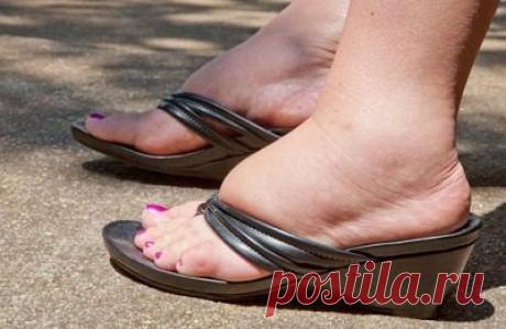 Как убрать отеки ног: традиционный и народные методы