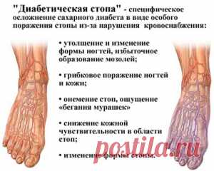 Как снизить повышенный сахар в крови