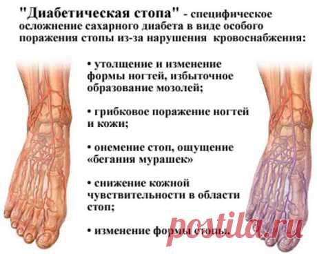 Как снизить повышенный сахар в крови