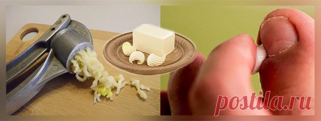 Лечение грибка ногтя, запущенная форма, на ногах...

Запущенный грибок ногтей невозможно вылечить без препаратов, предназначенных для употребления внутрь, то есть таблеток и капсул. Попадая в пищеварительный тракт человека, они легко всасываются в общий кровоток, оказывая мощное антимикотическое влияние на организм