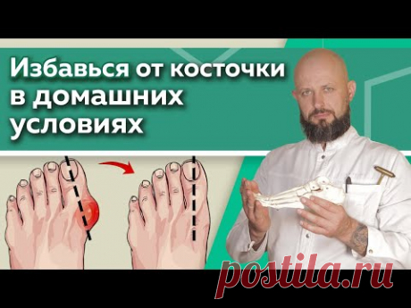 Как избавиться от шишки на ноге? / Эффективные упражнения для восстановления суставов