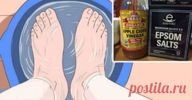 Ванна для ног с солью Эпсома и яблочным уксусом. Рецепт: Облегчит боль в течение 20 минут