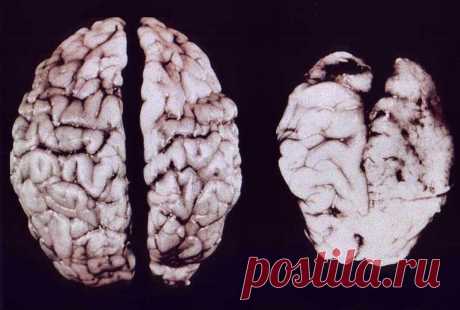 Академик Углов — правда и ложь о разрешённых наркотиках