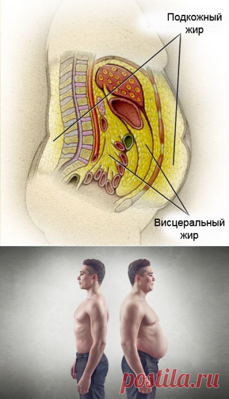 Висцеральный жир: источник проблем у мужчин