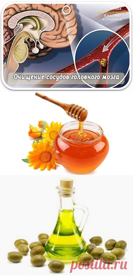 МОЗГИ