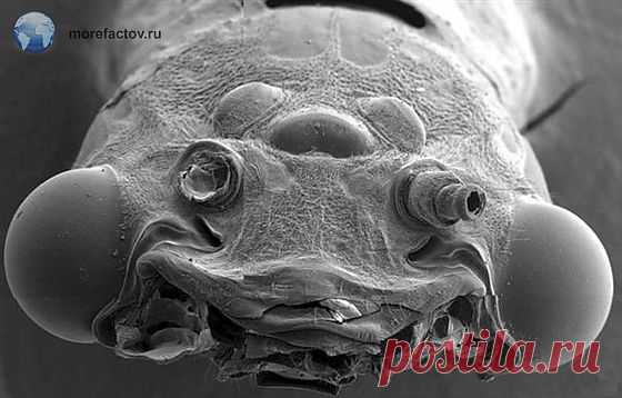 Удивительные факты о микробах