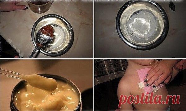 ЛЕПЕШКИ ОТ КАШЛЯ – 