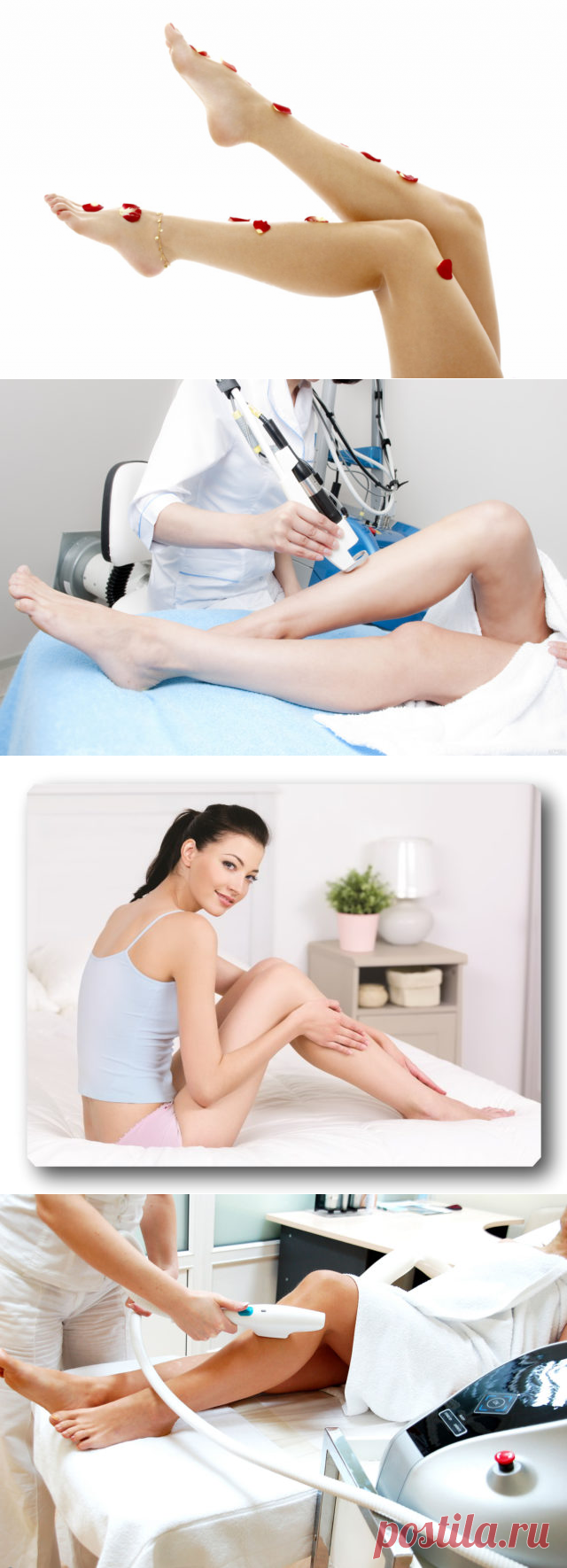 Что лучше Элос-эпиляция или фотоэпиляция?