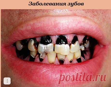 Предметы личной гигиены полости рта: зубные щетки, зубные нити (флосы), скребок для языка...