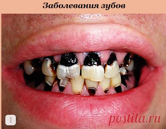 Предметы личной гигиены полости рта: зубные щетки, зубные нити (флосы), скребок для языка...