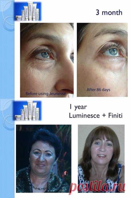 Вторая фотография это комбинация Сыворотки Люминесс + Финити. использование в течении одного года.