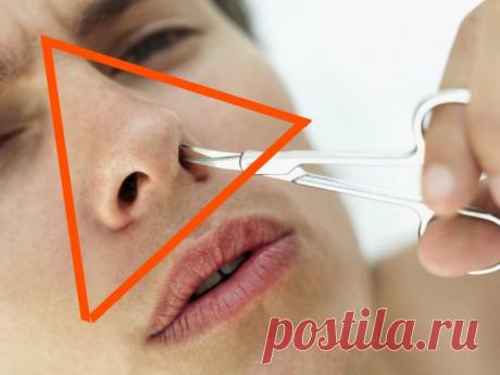 «Треугольник смерти» на лице: почему ни в коем случае нельзя трогать его руками!