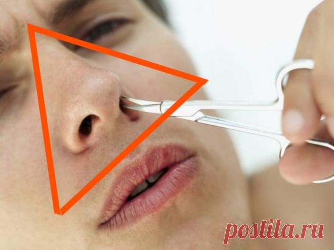 «Треугольник смерти» на лице: почему ни в коем случае нельзя трогать его руками!
