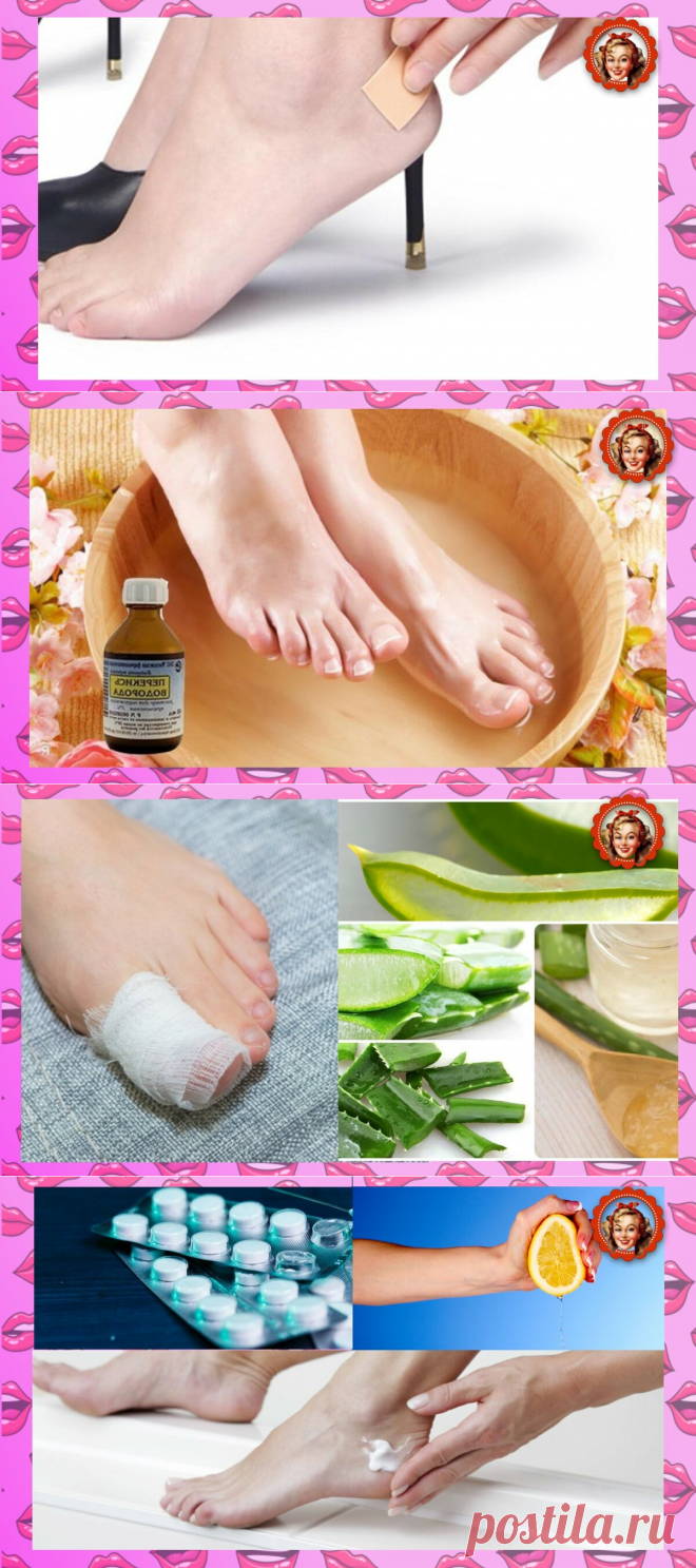 Делюсь проверенным способом избавления от мозолей и натоптышей | Мисс Понитта | Яндекс Дзен