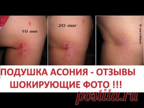 Подушка асония отзывы - ШОКИРУЮЩИЕ ФОТО!