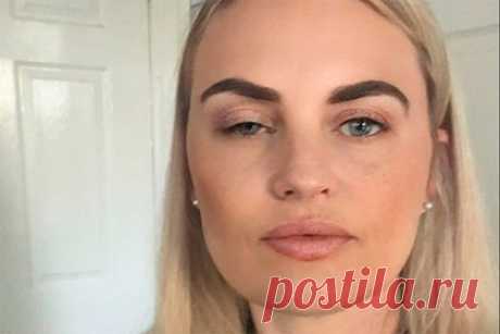 Невеста осталась с глазами разного размера из-за инъекций ботокса перед свадьбой. Невеста Карла Беллуччи из Хитчина, Англия, осталась с глазами разного размера из-за инъекций ботокса перед свадьбой. Незадолго до бракосочетания две клиники предложили британке указанные услуги бесплатно. Отмечается, что клиентка согласилась и сделала подряд четыре процедуры.