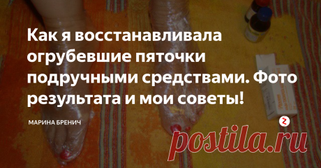 Как я восстанавливала огрубевшие пяточки подручными средствами. Фото результата и мои советы! ♥♥♥ Вам знакома ситуация, когда летом носишь открытую обувь, а из за этого пятки твёрже дерева? Хочется, чтобы ступни выглядели более или менее нормально? Перепробовала уже все рецепты и ничего особо не помогает?♥♥♥
