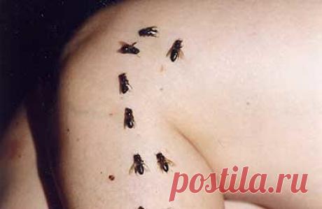 .    Апитокситерапия голеностопного сустава
. Категория: Пчелы в медицине
Опубликовано: 30 мая 2015
Деформирующий артроз — одна из наиболее распространенных форм заболевания суставов. Патогенез его очень сложный. Дистрофические изменения — многофакторный процесс. Нарушается кровообращение, появляется капиллярный стаз и гипоксия, изменяются аэробные и анаэробные окислительные процессы. В гиалиновом хряще уменьшается количество белково-полисахаридных комплексов, что в свою очередь приводит к сниж