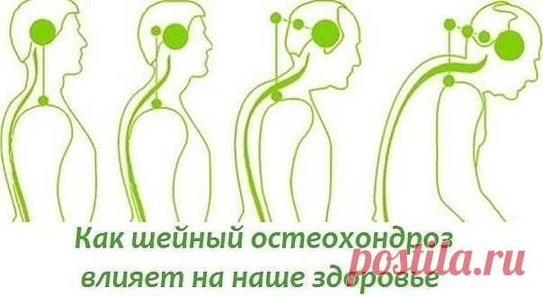ОСТОРОЖНО БОЛИТ ШЕЯ?