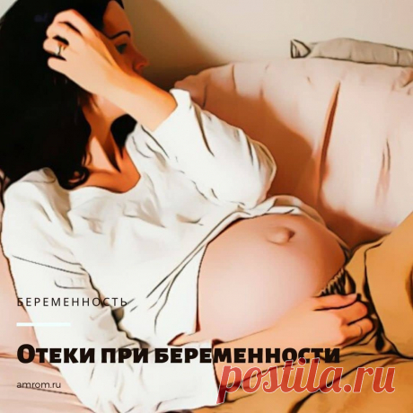 Отеки при беременности: виды, причины, диагностика, лечение. Многие женщины во время периода беременности начинают страдать от различного рода отеков. Встает вопрос: «Что является причиной отеков и что делать, чтобы от них избавиться?». В этой статье мы постараемся помочь будущим мамочкам в этом вопросе. Мы расскажем о видах отеков, симптомах, причинах, опасностях, с ними связанных, ну и, конечно же, о методах лечения данного заболевания. Итак, начнем.