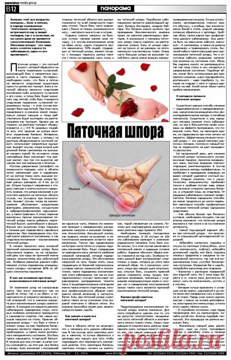 Пяточная шпора