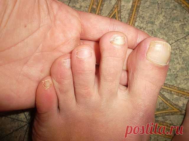 (27) Одноклассники