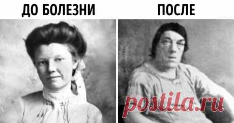 Любящая мать готова ради своих детей на все. Мэри Энн Вебстер (в замужестве — Беван) относится к их числу: она не побоялась стать объектом для насмешек, выставив свою нетипичную внешность на всеобщее обозрение. У нее была цель: во что бы то ни стало прокормить детей. Мэри предстояло пройти через оскорбления, унижения и чудачества зрителей, которые хотели поглазеть на «самую уродливую женщину в мире».