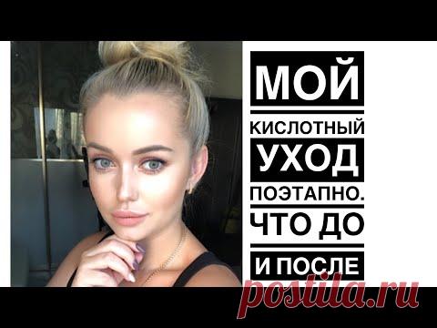 КИСЛОТЫ поэтапно 1 ДЕНЬ