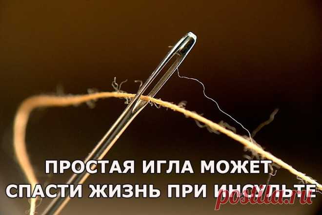 Простая игла может спасти жизнь при инсульте! - ХОЗЯЮШКА24