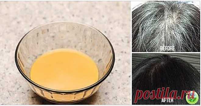 Домашнее средство, которое возвращает седым волосам естественный цвет! - Журнал для женщин Воспользуйтесь советом! Красивые волосы — это то, что мы все любим. Блестящие, сочные, здоровые и длинные волосы — желание каждого, но у многих людей выпадают волосы, седеют, секутся и т. д.. Польза для здоровья от ингредиентов Польза для здоровья от имбиря Корень имбиря изобилует фосфором, витаминами, калием и магнием, которые придают нашему волосяному фолликулу питательные […]