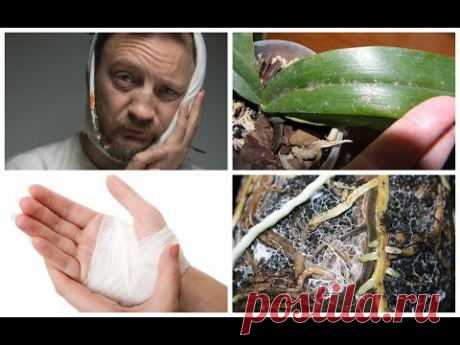 ЧТО ИСПОЛЬЗОВАТЬ ПРОТИВ ПЛЕСЕНИ , БАКТЕРИЙ , ВИРУСОВ #ПЛЕСЕНЬ_НА_ОРХИДЕЯХ #97 #oldenburgru - YouTube