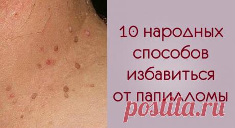 Средства и травы, избавляющие от вируса папилломы Вылечиться от папиллом в домашних условиях не так уж и сложно. Выбирайте подходящий рецепт!