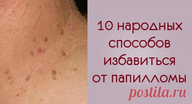Средства и травы, избавляющие от вируса папилломы Вылечиться от папиллом в домашних условиях не так уж и сложно. Выбирайте подходящий рецепт!