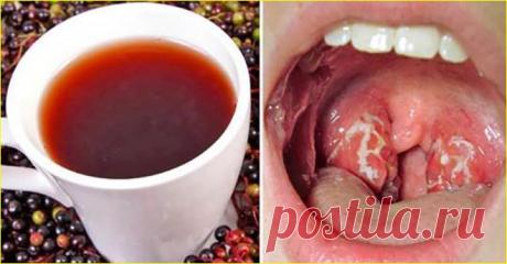 Всього 4 години – і симптомів ангіни наче й не було. Засіб від болю в горлі