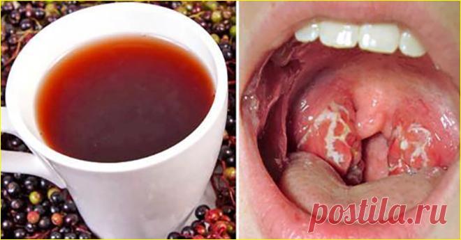 Всього 4 години – і симптомів ангіни наче й не було. Засіб від болю в горлі