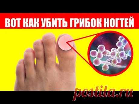 Грибок На Ногах. 90% людей не знают этих ошибок при лечении