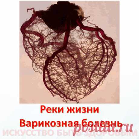 Реки жизни Варикозная болезнь
Если бы была возможность заглянуть внутрь человеческого организма, то сосуды среднестатистического человека старше 45 лет, не предъявляющего никаких жалоб и считающего себя вполне здоровым, удивили бы, как минимум. Во- первых – сложностью организации работы сосудистого русла, а во – вторых – его стойкостью к неблагоприятным факторам.
Система обеспечения 
Сосуды человеческого организма выполняют важнейшую функцию