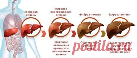 ЗДОРОВАЯ ПЕЧЕНЬ - ЗДОРОВЫЙ ОРГАНИЗМ